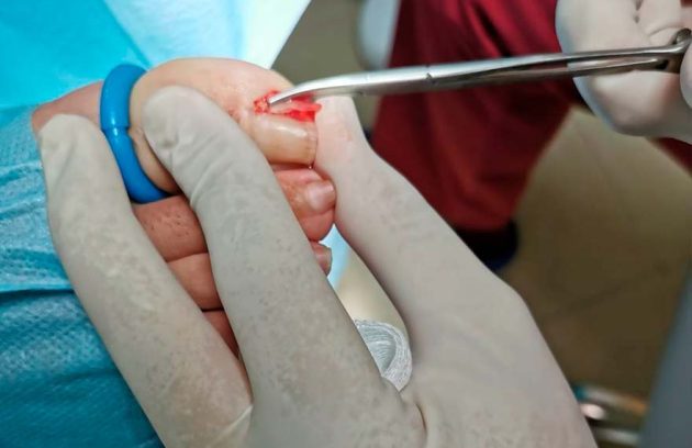 Fotografía de ornicocriptosis