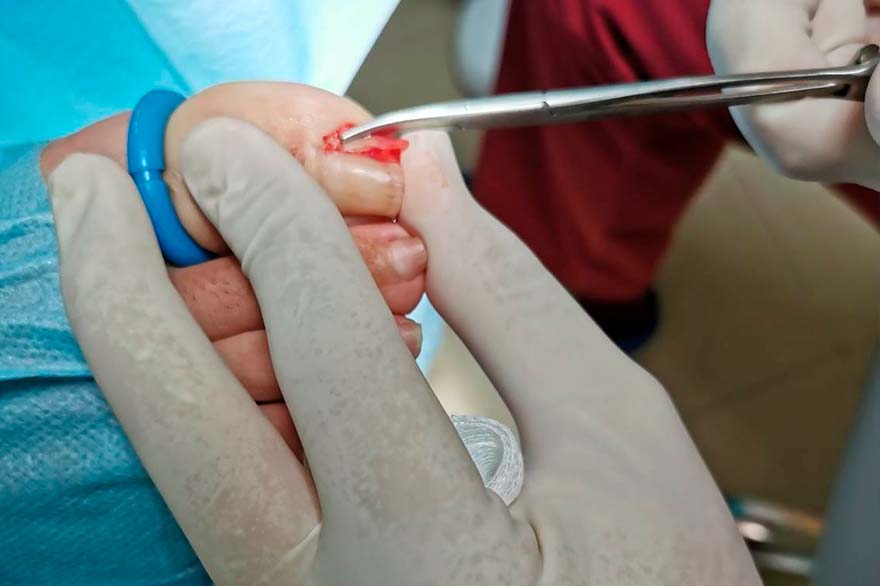 Fotografía de ornicocriptosis